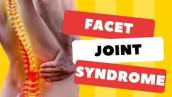 Top 3 Signs Your Back Pain is Facet Joint Syndrome-Symptoms \u0026 Signs