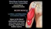 Distal Biceps Tendon Repair \u0026 Nerve Vulnerability - Everything You Need To Know - Dr. Nabil Ebraheim